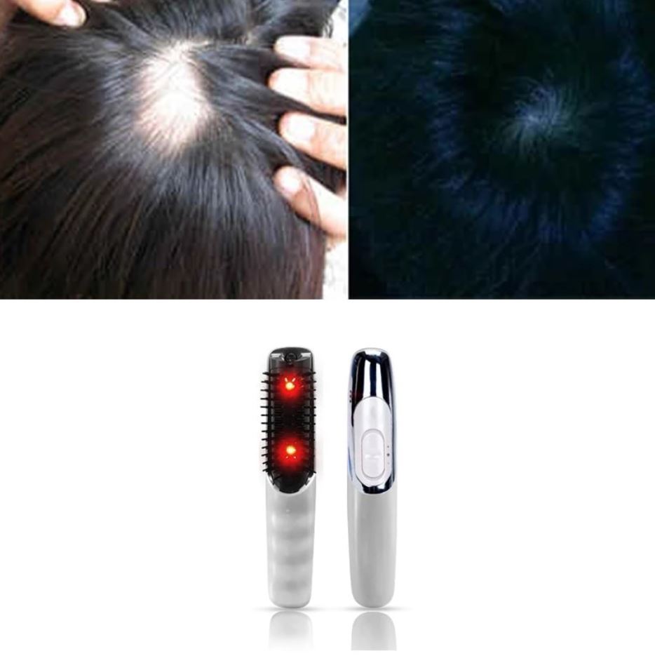 Anti Hair Loss Therapy Comb - Hair Growth Laser